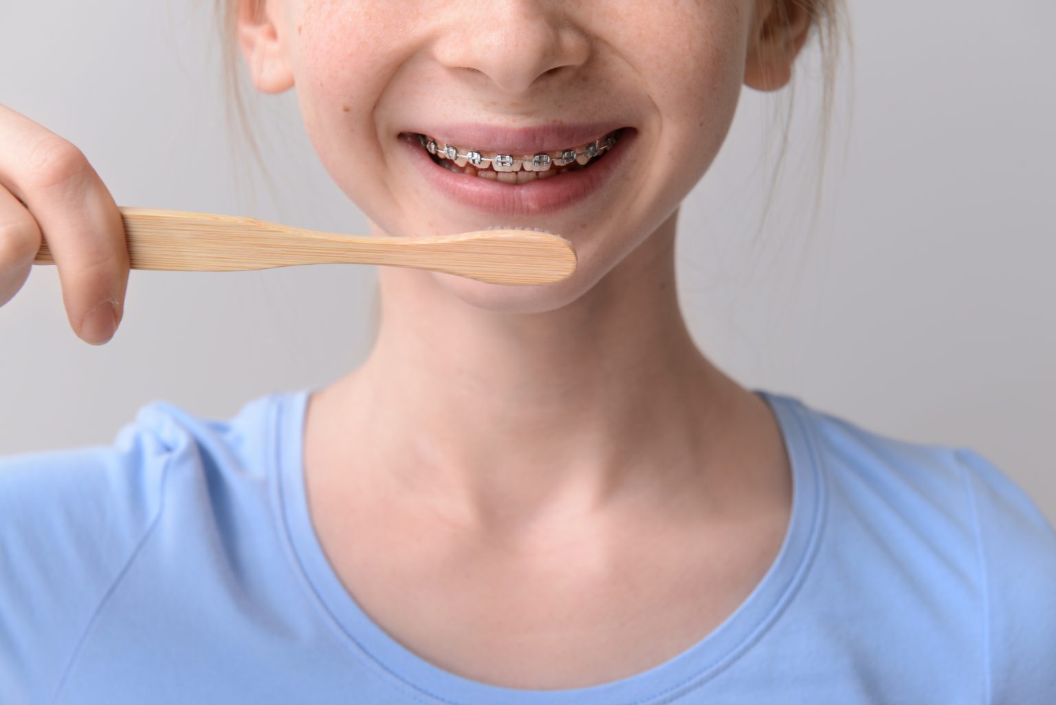 Traditional Braces in Chattanooga