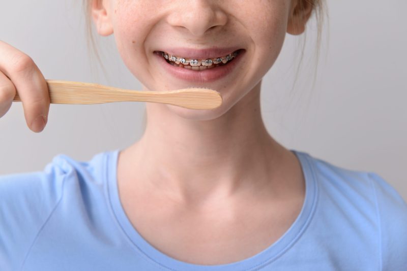 Traditional Braces in Chattanooga
