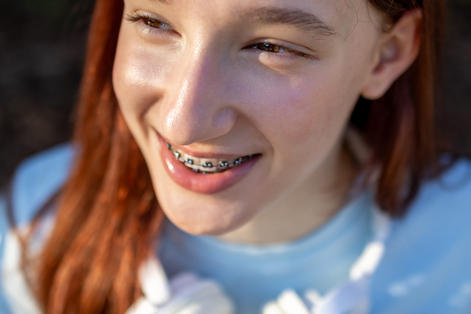 Braces for Teens in Lafayette