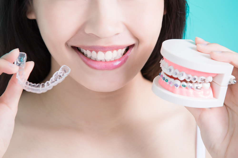 Orthodontist in Chattanooga